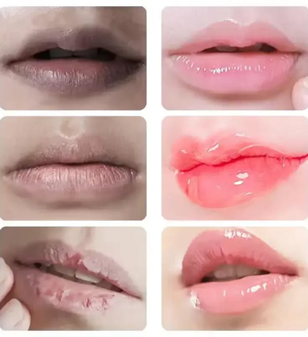 Lip Balm For Remove Dark Lip Melanin Dead Skin Removal Lighten Exfoliate Whitening Moisturizing Nourishing Lip Care