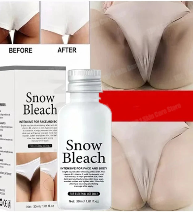 HOT~Whitening Cream Private Parts Underarm Bleaching Serum Whiten Butt Knee Brighten Inner Thigh Intimate Parts Dark Remove Mela