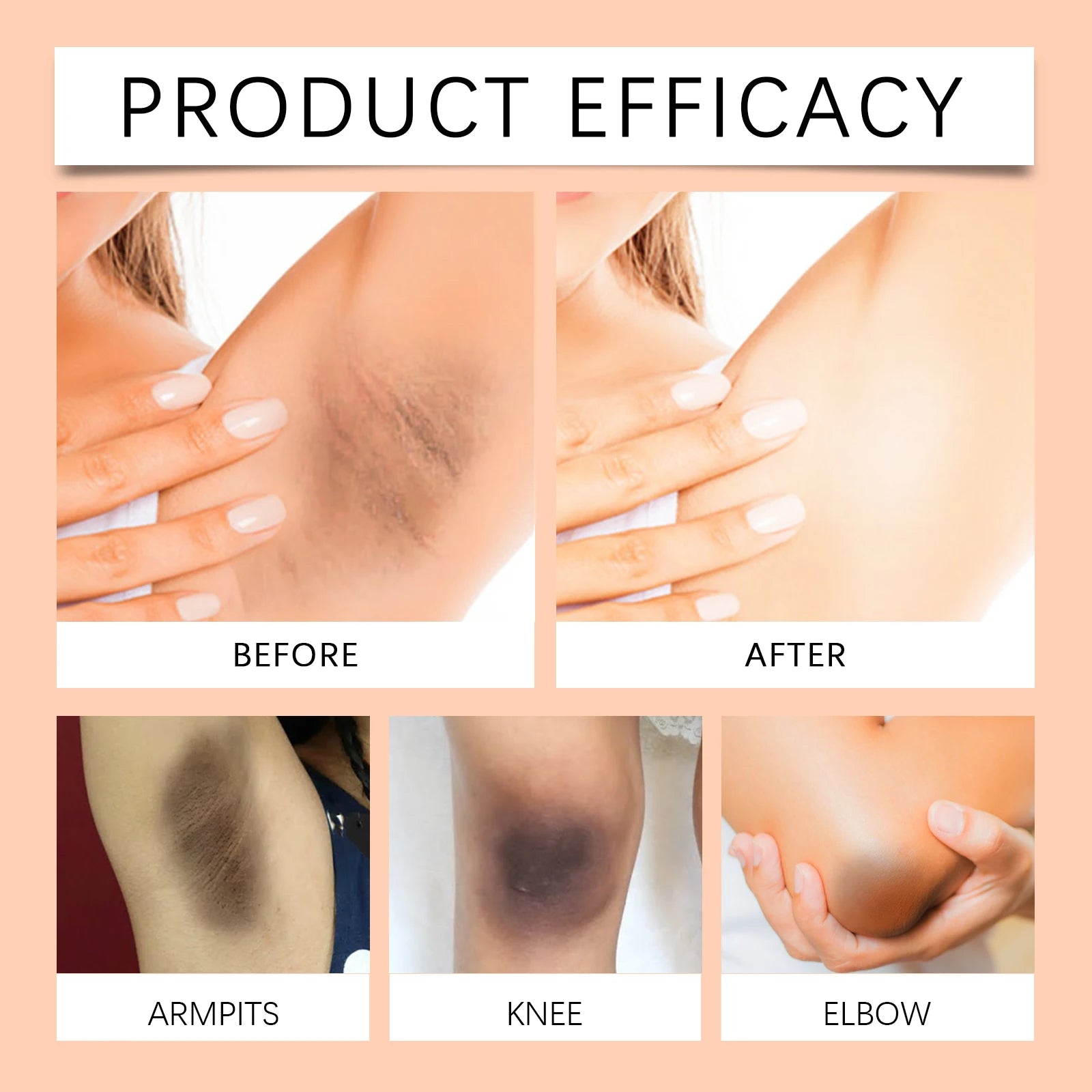 Underarm Whitening Cream Armpit Legs Knee Elbow Cream Remove Dark Spots Melanin Brighten Skin Care Moisturizing Skin Cream 50g