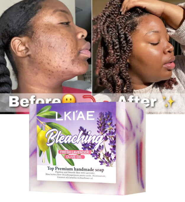 Fresh Lavender Oil Soap Bar, Whitening, Reduce Acne, Smooth Skin, With Niacinamide, Glutathione, For All Skin Types, 150g/5.3 oz