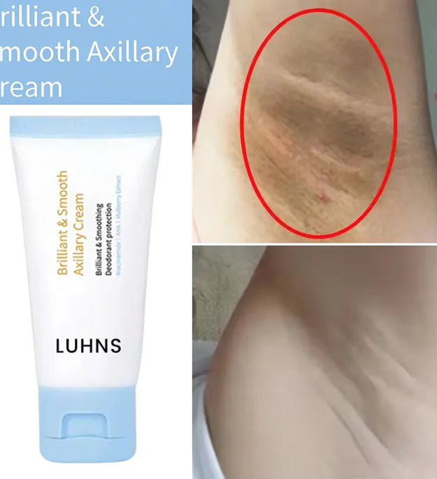 Whitening Cream For Dark Skin Underarm Bleaching Armpit Lightening And Intimate Area Woman Moisturizer Korean Skin Care Products