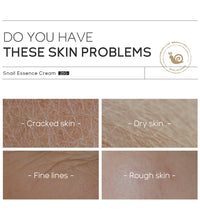 Snail Collagen Face Cream Anti-aging Moisturizing Nourish Repair Face Damaged Lift Firm Smooth Whitening Skin Care Day Cream - BlissFully