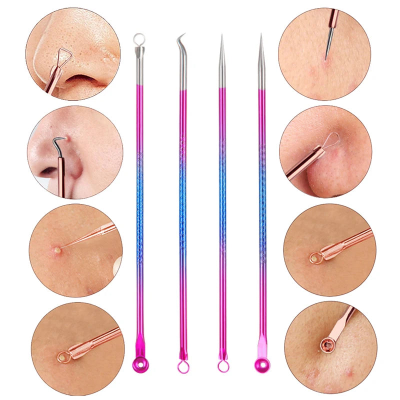 4PCS Acne Blackhead Comedone Black Spot Pimple Blemish Remover Skin Care Women Beauty Acne Treatment Pore Cleanser Needle Hook - BlissFully