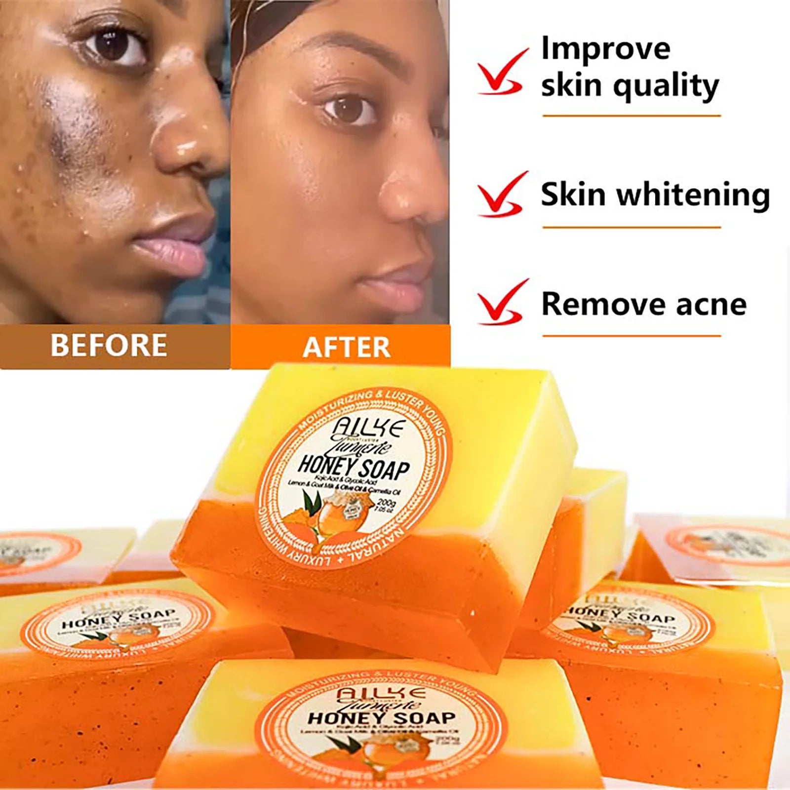 AILKE Natural Turmeric Honey Soap Bar, Whitening, Clean Skin, Remove Dark Spots, Stains, With Kojic Acid, Lemon, 200g/7 oz