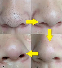 10/20/50PCS Nose Blackhead Remover Mask Shrink Pore Acne Treatment Sticker Black Dots Strips Nose Deep Cleansing Cleane - BlissFully