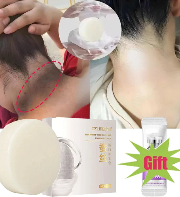 Body Whitening Soap Underarm Knee Bleaching Soap Chicken Skin Removal Dark Spot Removal Dead Skin Moisturize Brighten Body Care