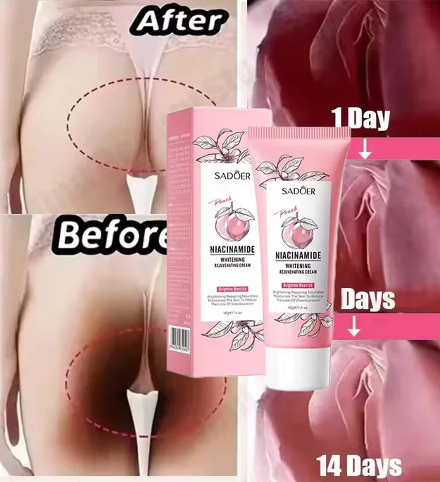 Body Whitening Cream Dark Skin Armpit Lightening Intimate Areas Underarm Bleaching Private Parts Whiten Cream Body Lotion Beauty