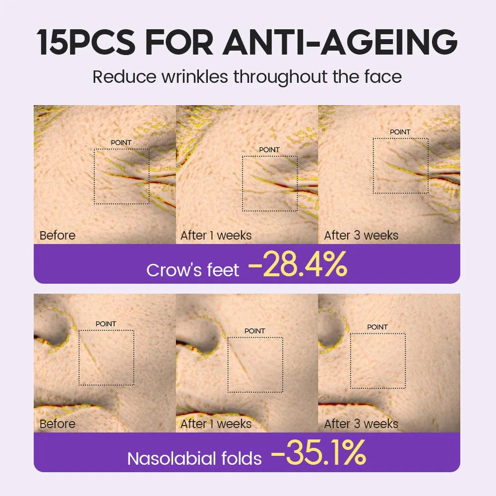 Retinol + Pro-xylane Ampoule serum  Repairs Strengthens The Skin And Diminishes Fine Lines Face Beauty Skin Care 15pcs - BlissFully