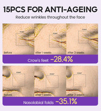 Retinol + Pro-xylane Ampoule serum  Repairs Strengthens The Skin And Diminishes Fine Lines Face Beauty Skin Care 15pcs - BlissFully