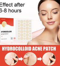 Hydrocolloid Acne Patches 2 Sizes Invisible Makeup-Friendly Pore Care Acne Pimple Patch Breathable for Comedones Treatment - BlissFully
