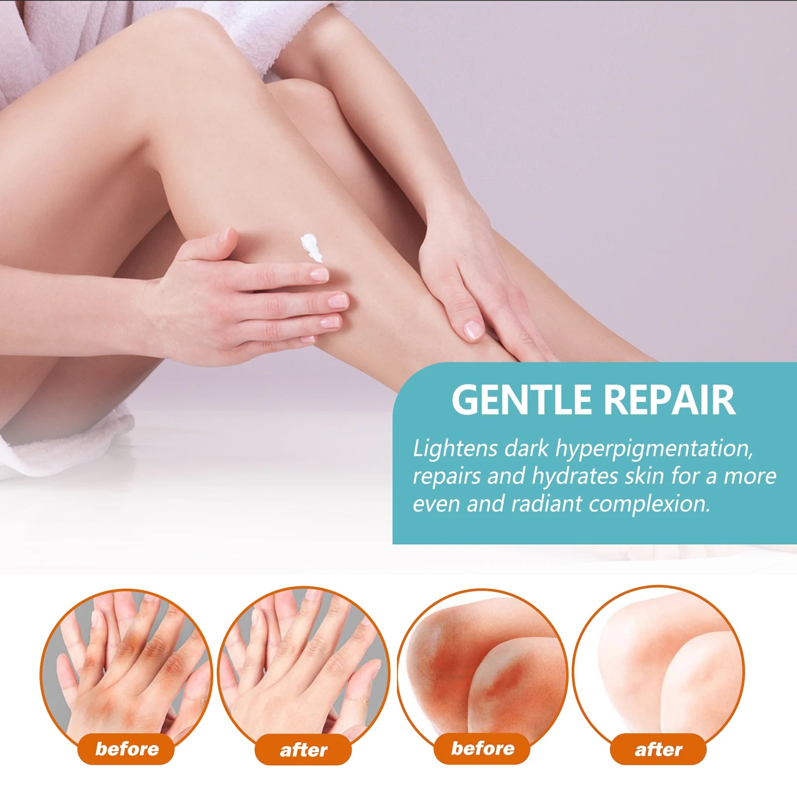 EELHOE Whitening Cream Brightening Skin For Dark Skin Neck Arm Knee Joint Underarm Body Care Acanthosis Nigricans Therapy Cream