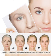 Anti Acne Turmeric Cream, Fades Scars & Dark Spots, for Oily and Dull Skin, Brightening Turmeric Face Care Treatment, 50ml - BlissFully