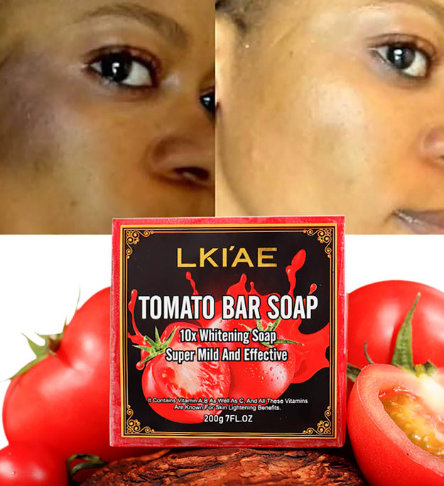 LKIAE Brand Tomato Fruit Scented Handmade Natural Bar Soap, For Face, Body, Whitening, Oil Control, Brightens, Shrink Pore, 200g
