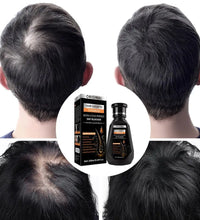 250ML Biotin Shampoo For Hair Growth And Thinning Hair – Ginger Shampoo Thickening Formula For Hair Loss Treatment For Women Men - BlissFully