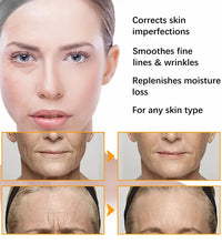 Anti Acne Turmeric Cream, Fades Scars & Dark Spots, for Oily and Dull Skin, Brightening Turmeric Face Care Treatment, 50ml - BlissFully