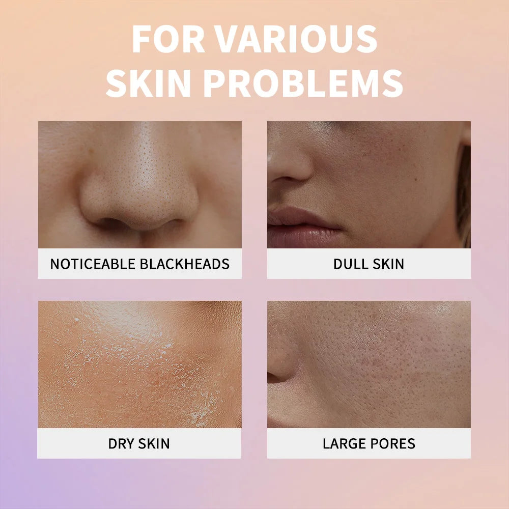 White Black Rice Peeling Essence Exfoliating Moisturizing Exfoliating Hydrating Serum Moisturizing Rice Toner Gentle Skin Care