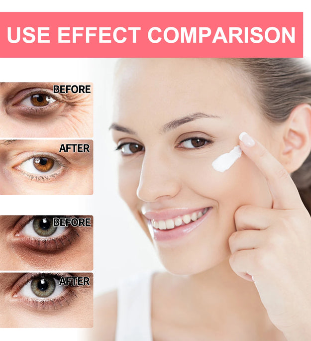 Retinol Eye Cream Stick Lightening Dark Circles Anti-Puffiness Smooth Brightening Moisturizing Firming Under Eye Treatment Care