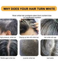 Hair Shampoo Soap Polygonum Multiflorum Black Soap White Hair Repair Soap Hair Care Set Nourishing Anti Dandruff Hair Dye Soap - BlissFully