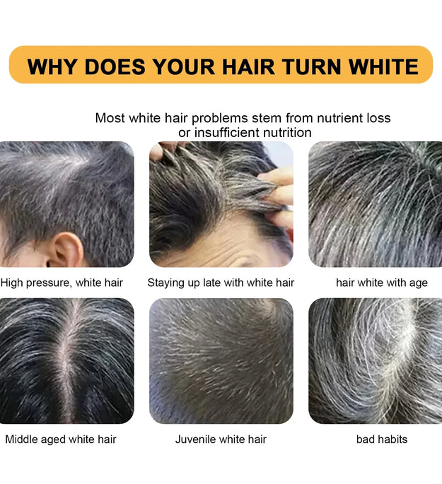 Hair Shampoo Soap Polygonum Multiflorum Black Soap White Hair Repair Soap Hair Care Set Nourishing Anti Dandruff Hair Dye Soap - BlissFully