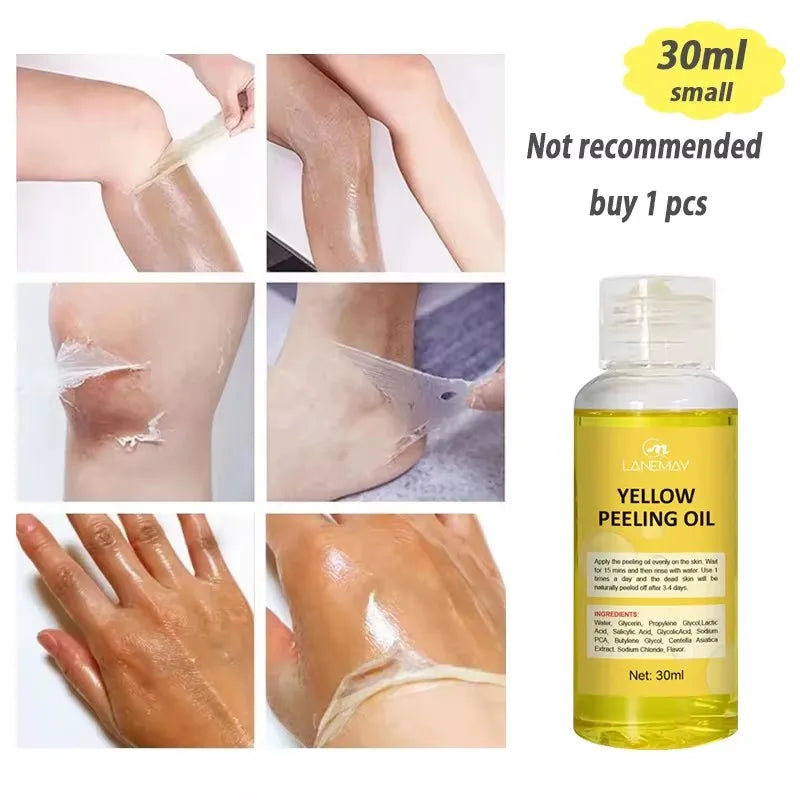 Strong Yellow Peeling Oil Bleach Dark Skin Whiten Lotion Lighten Body Elbow Knee Hand Exfoliate Dead Skin Nourish Even Skin Tone - BlissFully