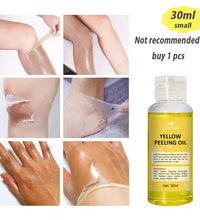 Strong Yellow Peeling Oil Bleach Dark Skin Whiten Lotion Lighten Body Elbow Knee Hand Exfoliate Dead Skin Nourish Even Skin Tone - BlissFully