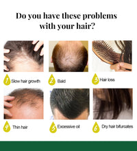 Ginger Care Hair Spray Hair Growth Essence Nourish Hair Roots Massag Scalp Repair Hair Quality Control Oil Hair Care Solution - BlissFully