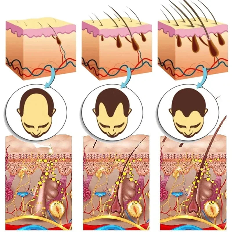 7 Days Ginger Hair Growth Serum Fast Promote Hair Regrowth Products Anti Hair Loss Repair Scalp Baldness Nourish Hair Root Care