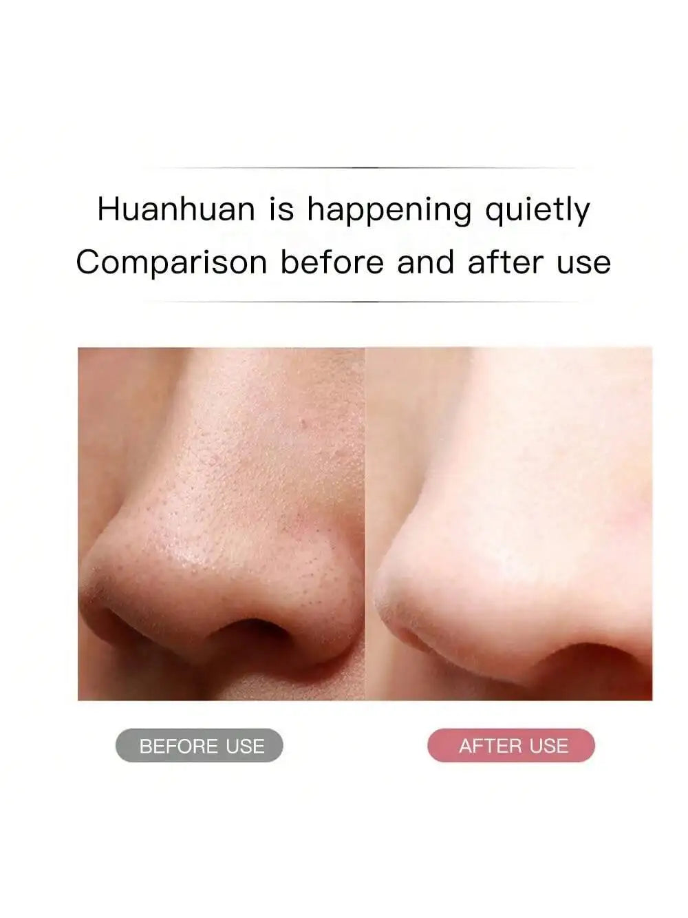 Ultrasonic Skin Scrubber Scrubber Deep Vibrate Facial Cleaner Shovel Face Scrubber Peeling Black Head Remover Facial Massager - BlissFully