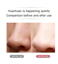 Ultrasonic Skin Scrubber Scrubber Deep Vibrate Facial Cleaner Shovel Face Scrubber Peeling Black Head Remover Facial Massager - BlissFully