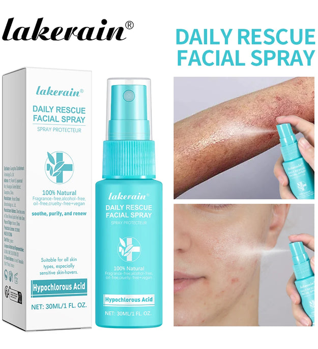 30ml Rescue Facial Spray For Sensitive Skin Hypochlorous Acid Spray Helps Reduce Redness Breakouts Soothing Balancing Spray