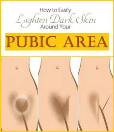 Women Vaginal Lips Private Part Pink Underarm Intimate Whitening Dark Nipple Anal Bleaching Cream Skin Care Body Cream Original