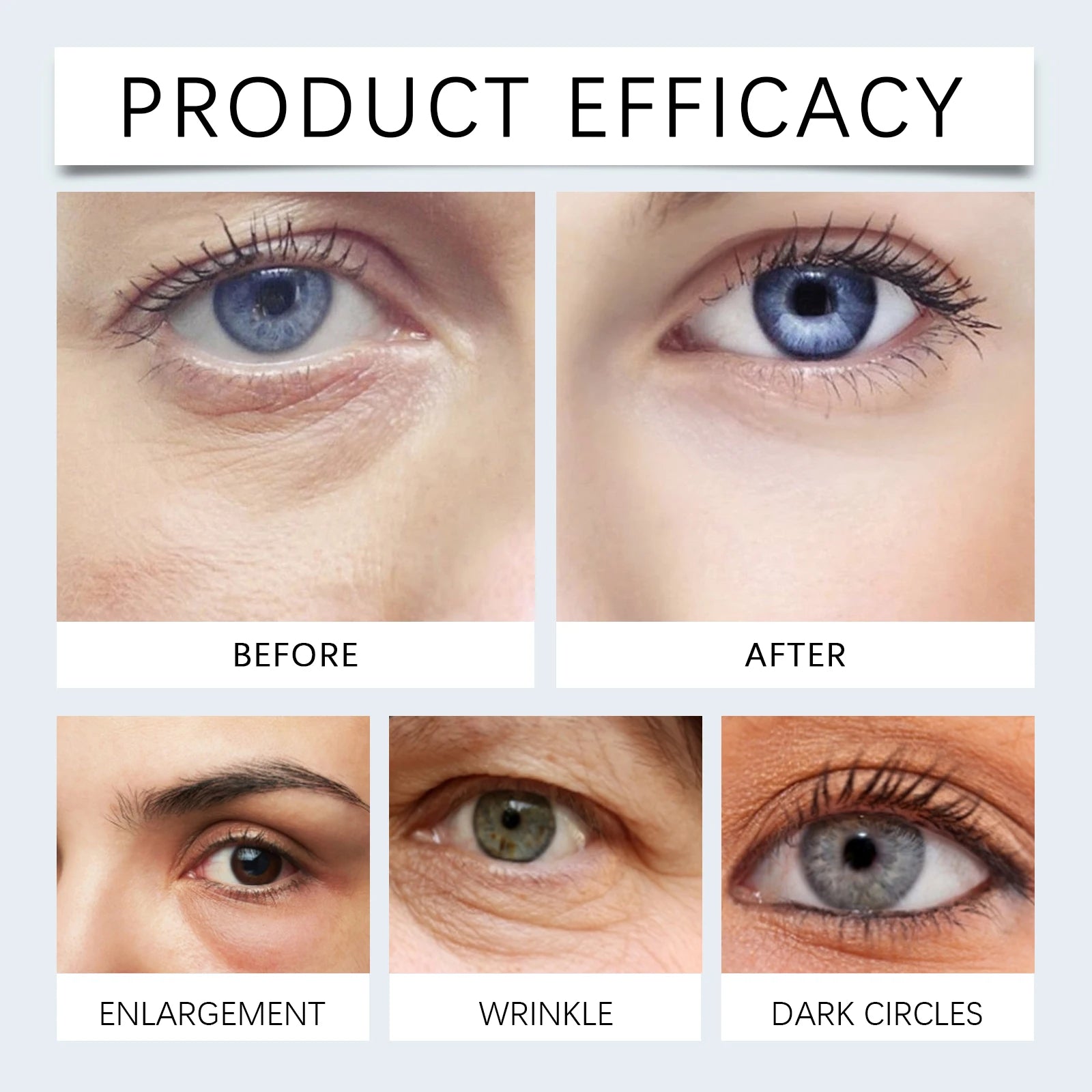 Moisturizing And Hydrating Eye Mask Gently Nourishes And Lightens Wrinkles Around The Eyes Leaving The Skin Smooth And Delicate