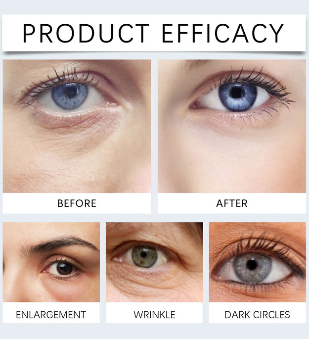 Moisturizing And Hydrating Eye Mask Gently Nourishes And Lightens Wrinkles Around The Eyes Leaving The Skin Smooth And Delicate