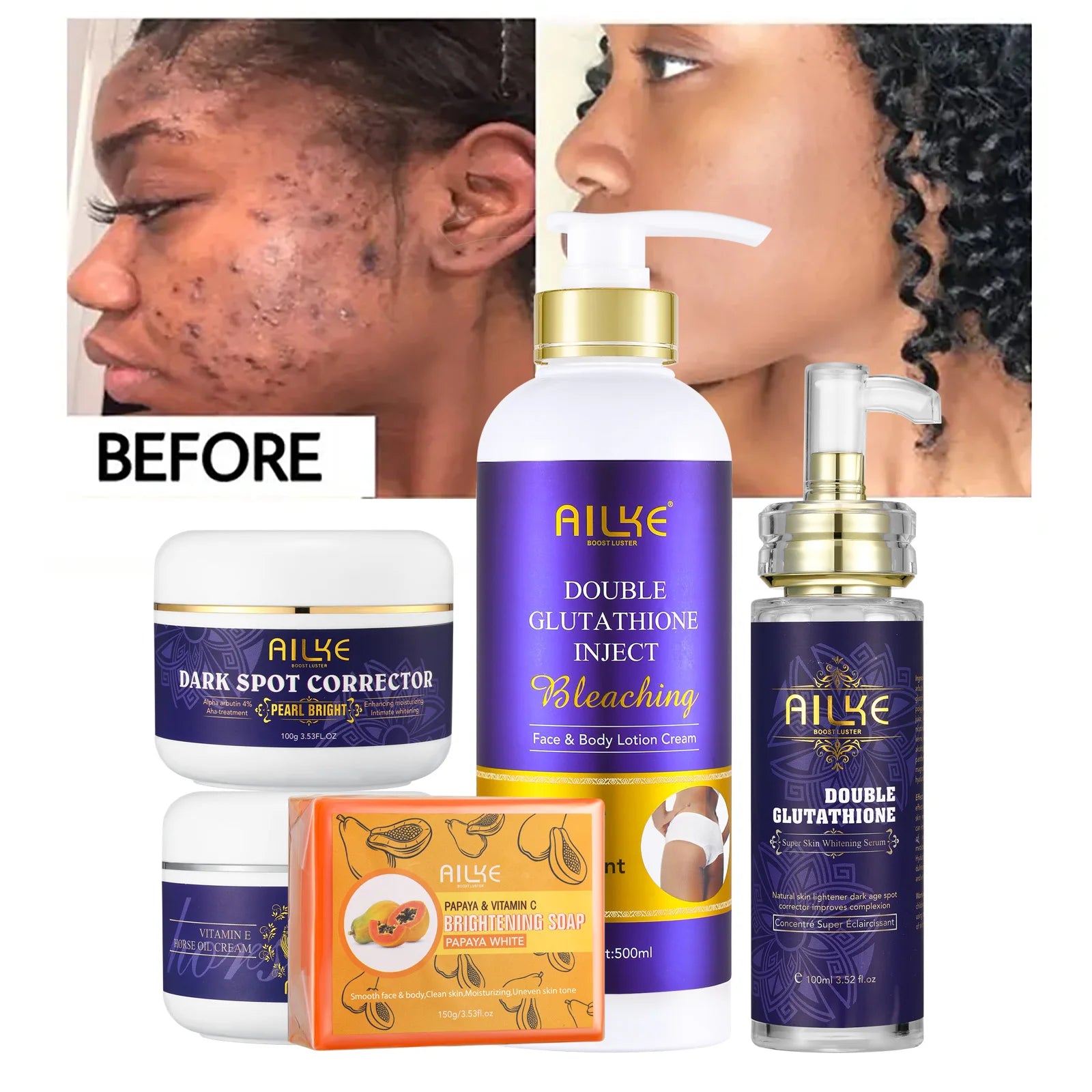 AILKE Glutathione 5-in-1 Women Skin Care Kit, With Body Lotion,  Serum, Dark Spot Removal Cream, Body Cream, Brightening Soap - BlissFully