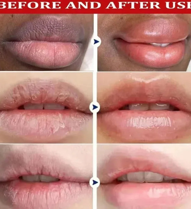 Fast Remove Dark Lip Balm Serum Lighten Melanin Lip Mask Exfoliating Fade Lip Lines Dead Skin Nourishing Repair Lip Care Makeup