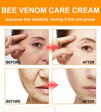 Bee venom moisturizing facial lifting, firming, reducing fine lines, eye bags, whitening and skincare gift box for women - BlissFully