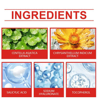 240pcs Star Acne Patches Invisible Pimple Cover for Face Oil Control Spot Treatment Cute Sticker for Covering Zits and Blemishes - BlissFully