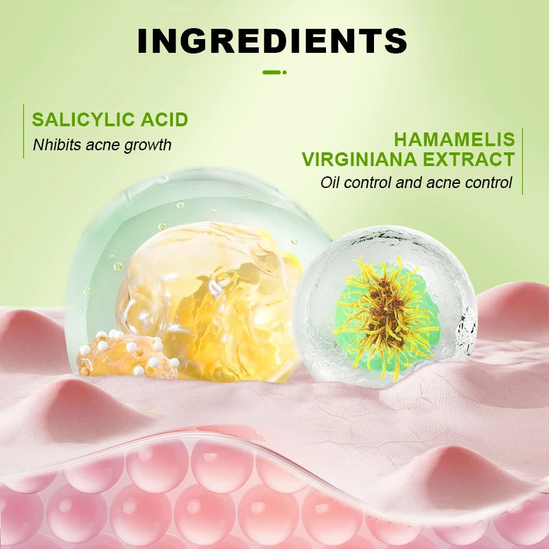 AUQUEST Herbal Acne Treatment Face Serum Salicylic Acid Oil Control Pimple Remover Facial Acne Removal Skin Care - BlissFully