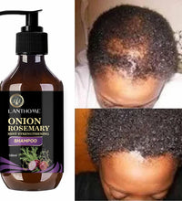 100ML Hair Shampoo For Fast Hair Growth Rosemary Onion Shampoo 30ML Spray Anti Hair Loss Effective Within 7 Day Hair Growth - BlissFully