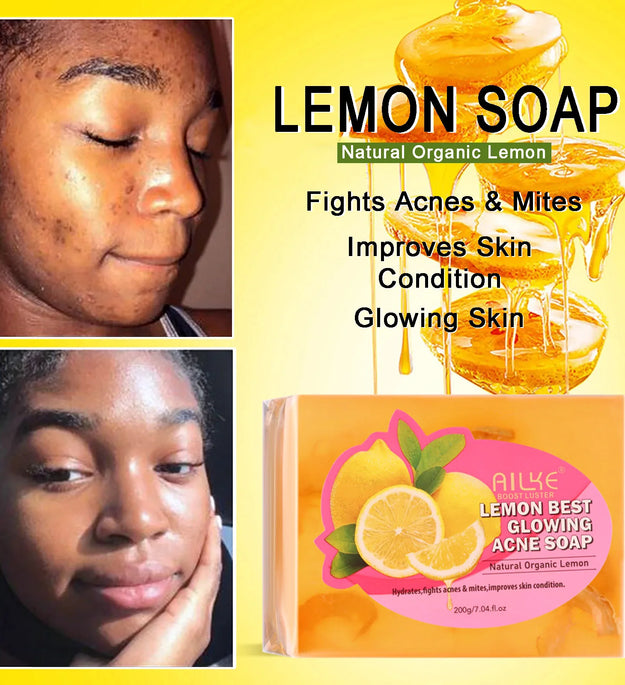AILKE Dark Spots and Acne Remover Soap Bar, Whitening Skin with Natural Lemon, Olive Oil, Women Daily Face and Body Wash, 200g