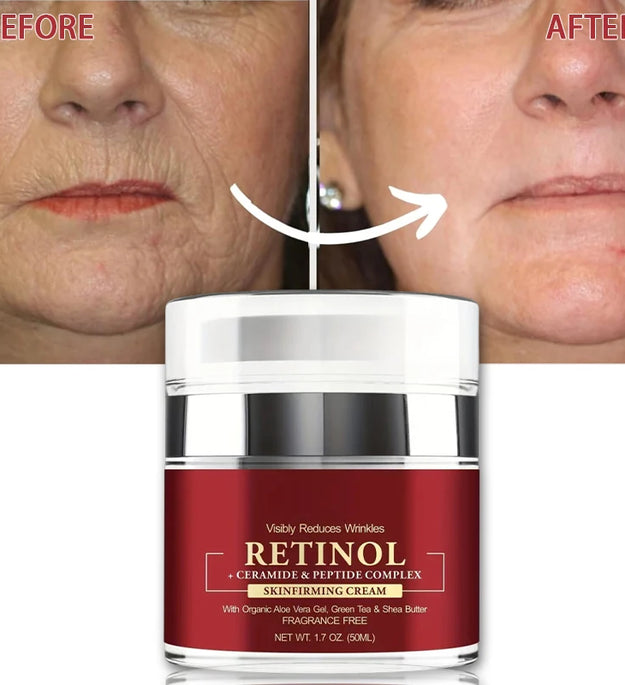 Instant Retinol Cream Wrinkle Remover Firming Lifting Anti Aging Fade Fine Lines Moisturizing Whitening Korea Repair Skin Care - BlissFully