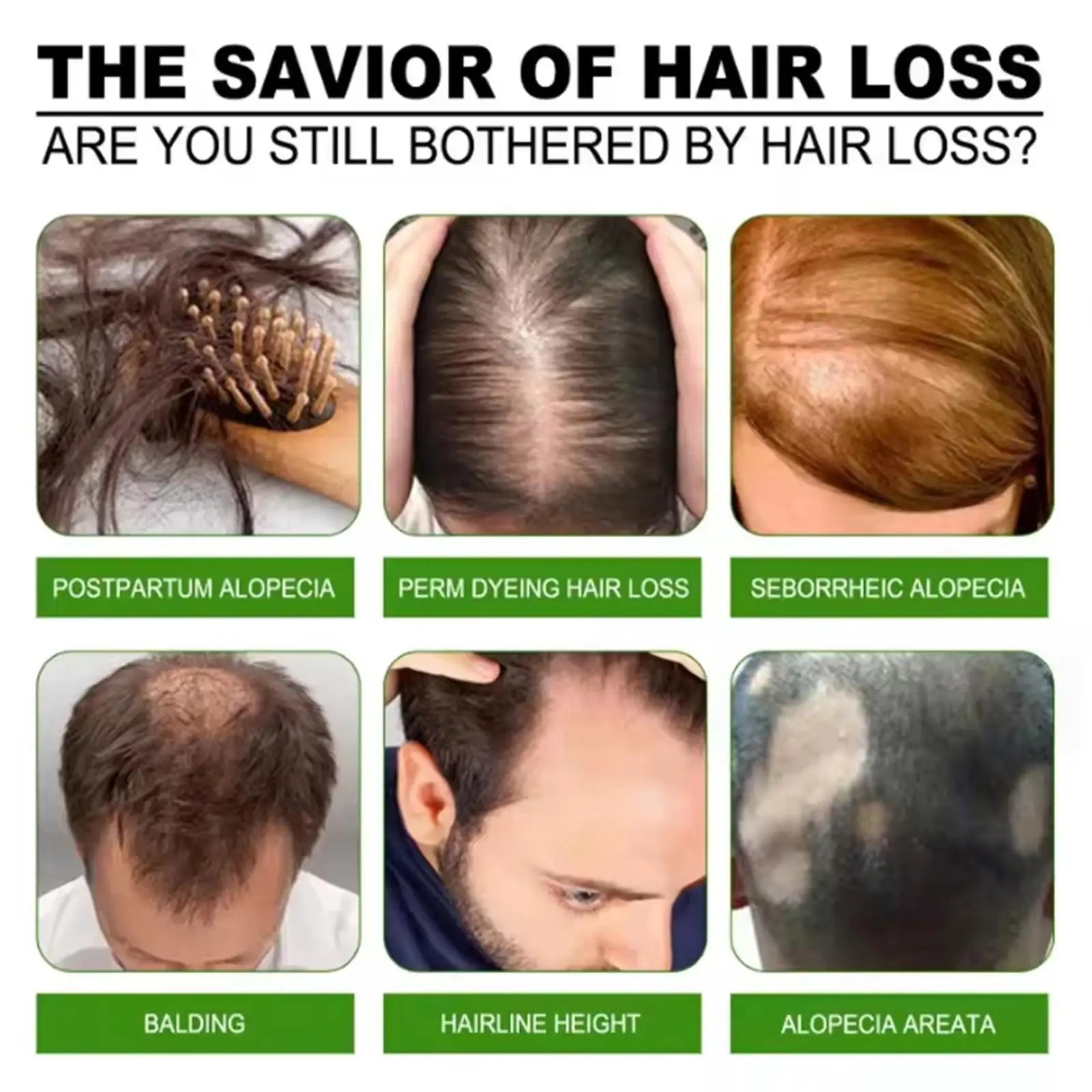 Fast Hair Growth Serum Hair Regrowth Essential Oil Anti Hair loss Repair Damaged Scalp Women Men Anti Baldness Hair Growth Care