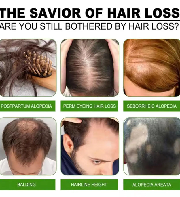 Fast Hair Growth Serum Hair Regrowth Essential Oil Anti Hair loss Repair Damaged Scalp Women Men Anti Baldness Hair Growth Care