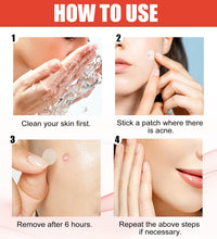 Hydrocolloid Acne Patches 2 Sizes Invisible Makeup-Friendly Pore Care Acne Pimple Patch Breathable for Comedones Treatment - BlissFully