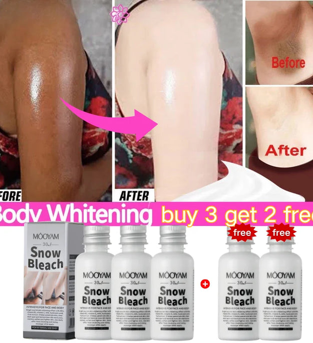 Remove Melanin Body Whitening Snow Bleach Cream Brighten Underarm Elbow Knees Joint Lighten Intimate Part Thigh Inner Dark Spot