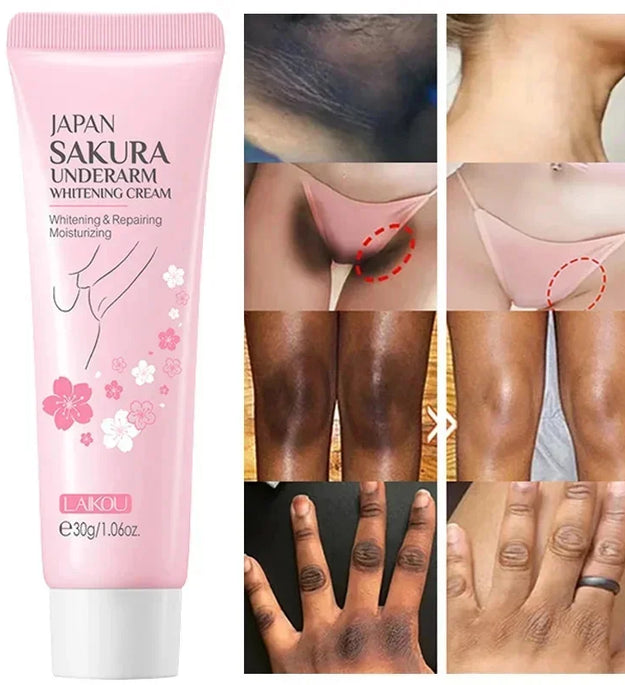 Whitening Cream For Dark Skin Armpit Thigh Inner Joint Lightening Intimate Area Underarm Body Care Private Parts Brighten Lotion
