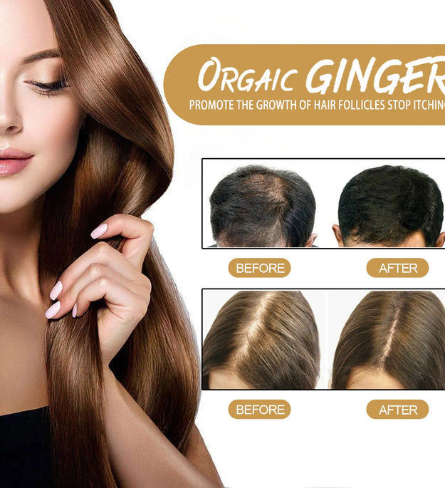 60g Natural Ginger Shampoo Soap Reduce Hair Loss Clean Dandruff Nourish Moisturize Scalp Improve Hair Quality Hair Care Product - BlissFully