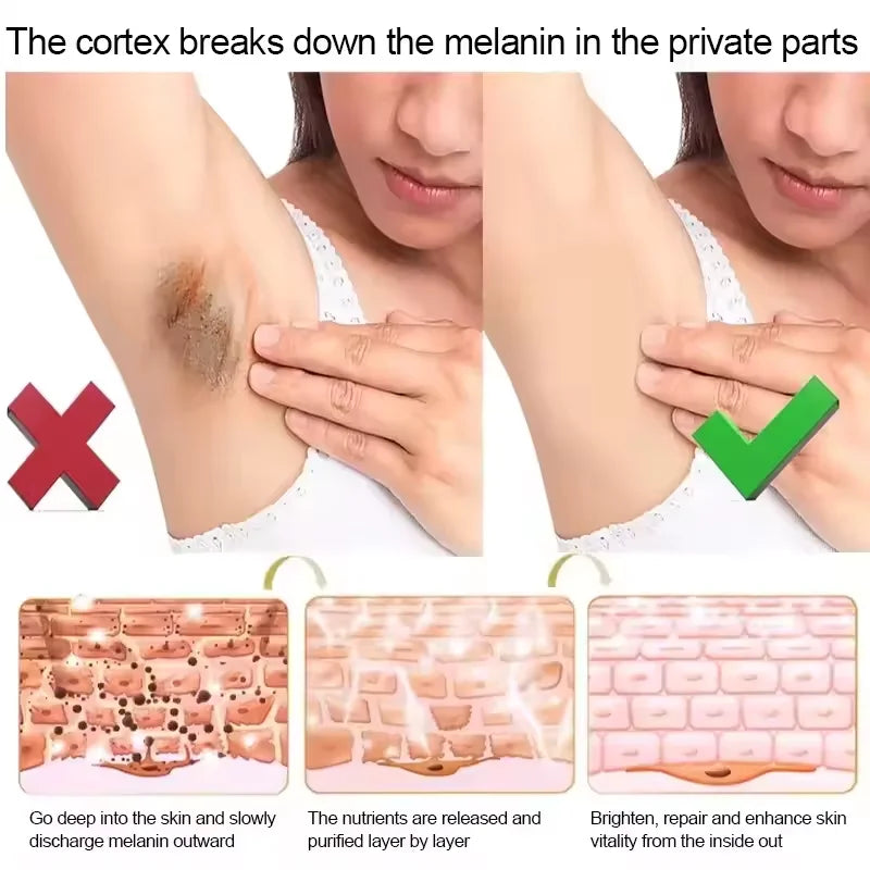 Body Whitening Cream Dark Skin Armpit Lightening Intimate Areas Underarm Bleaching Private Parts Whiten Cream Body Lotion Beauty