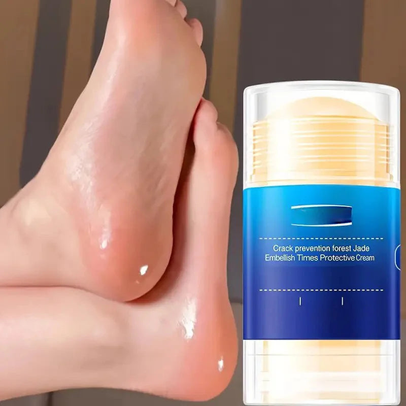 Dry and cracked heels, anti-crack cream, hand and foot hydration, moisturizing and moisturizing cream.