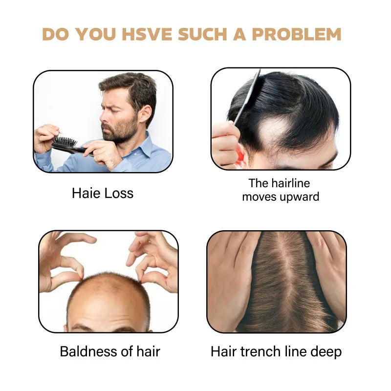 Anti Hair Loss Shampoo Fast Growing Repair Damaged Scalp Dry Frizzy Treatment Deep Nourishment Moisturizing Regrowth Conditioner - BlissFully